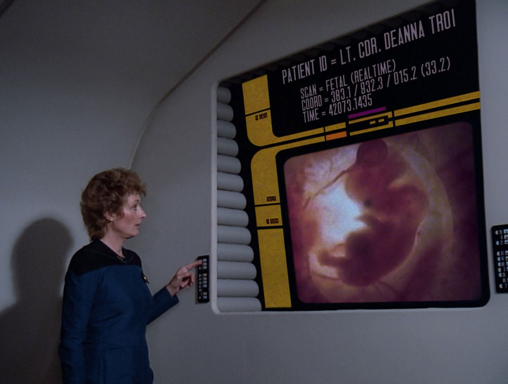 Pulaski_displays_fetal_scan